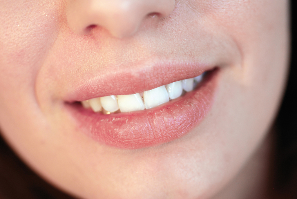 Home Remedies For Chapped Lips